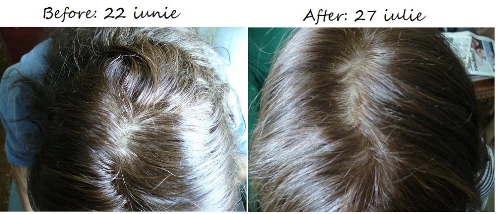 Tratament Dercos Neogenic Vichy, final luna 1